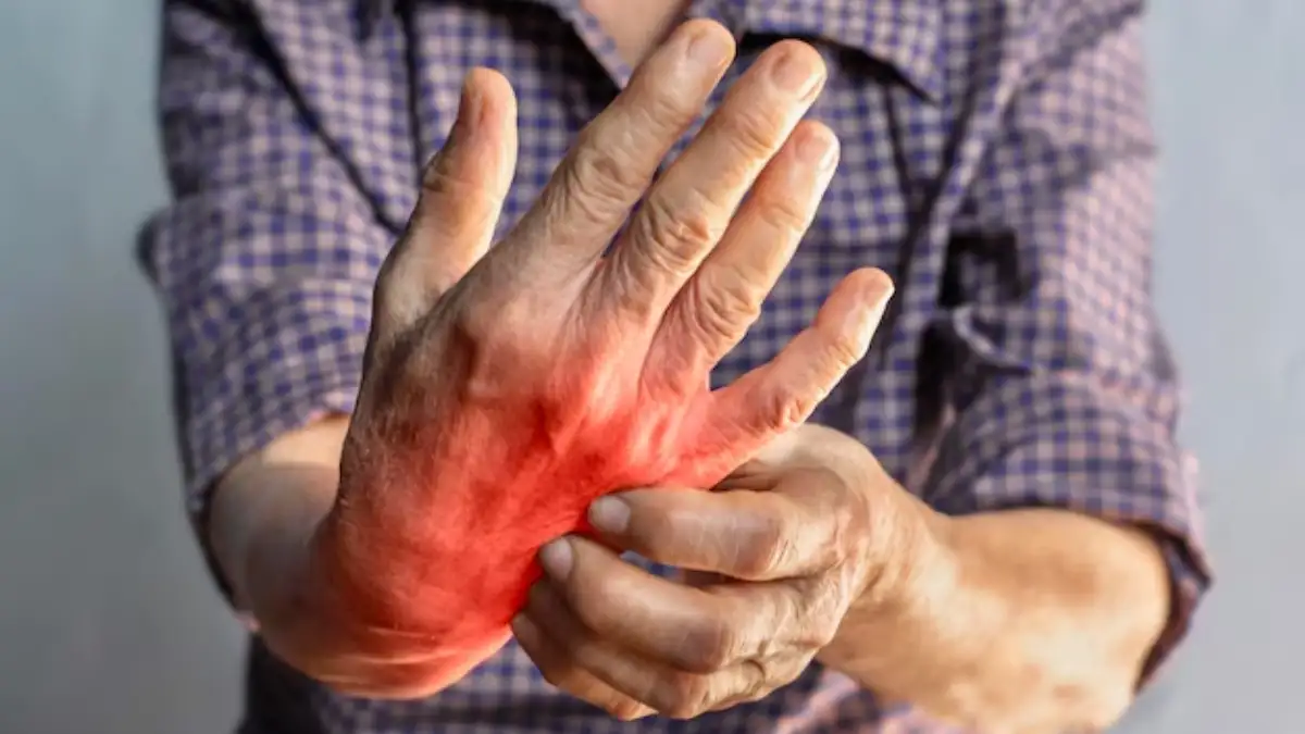 Debunking 5 common myths about Rheumatoid Arthritis